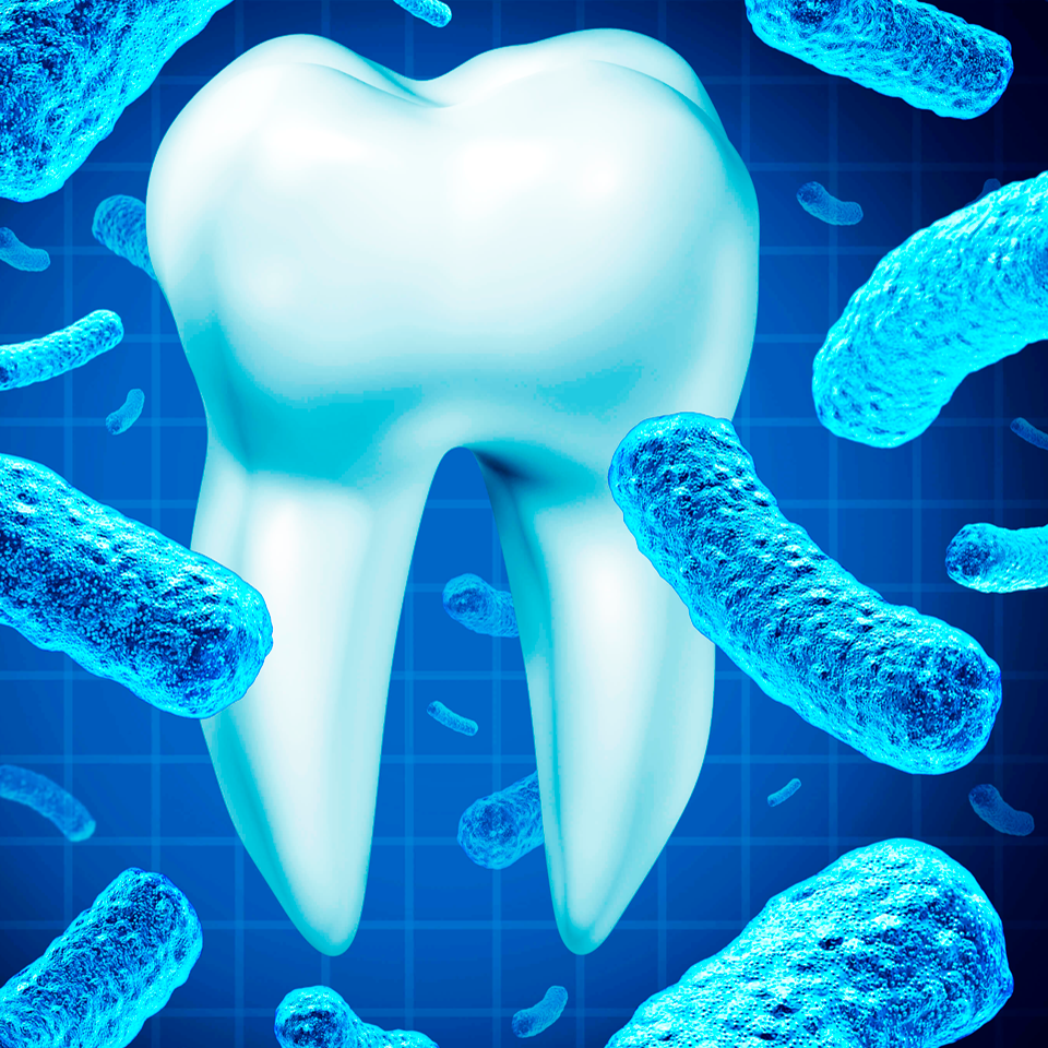 Periodoncia